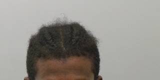 STL man burned baby boy in sink and caused severe brain injury