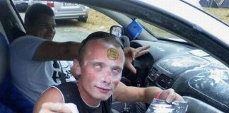 Police make Surprise Discovery When Prying Wig Off Cokehead